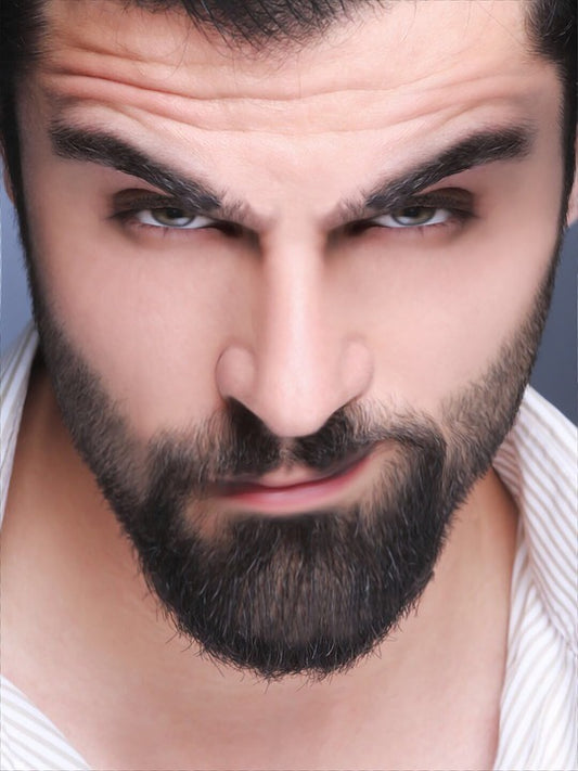 Beard Dandruff, AKA Seborrheic Dermatitis 
